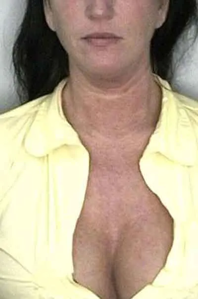 Vera, 42 år